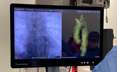 Cydar Medical, a Palermo la prima esperienza italiana di chirurgia vascolare intelligente