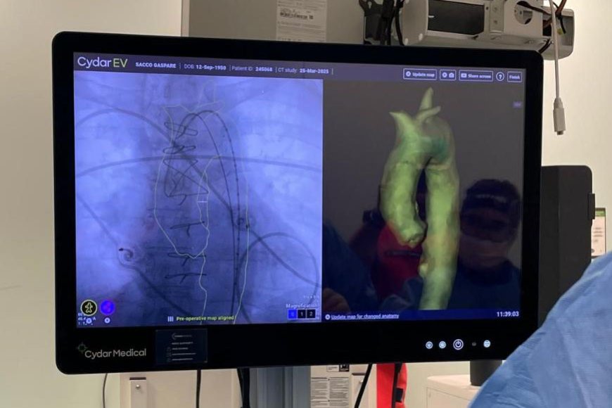 Cydar Medical, a Palermo la prima esperienza italiana di chirurgia vascolare intelligente